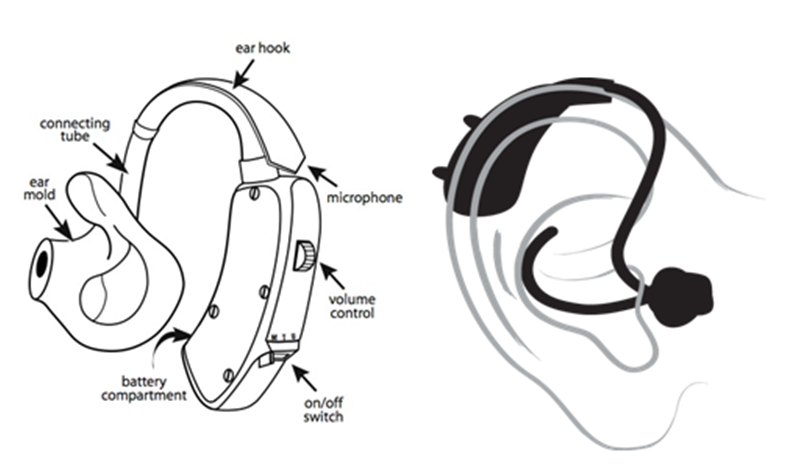 Senior with hearing aid