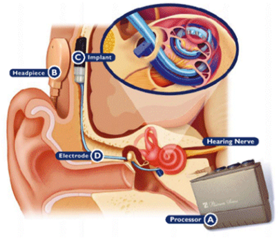 cochelar-internal-working